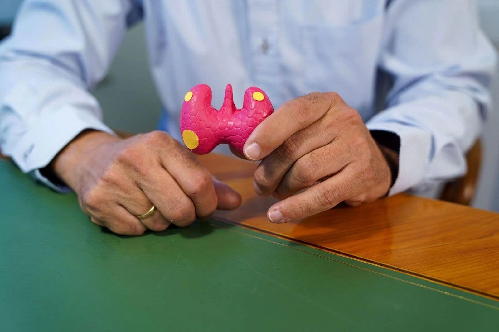 Anatomisches Modell mit den vier Nebenschilddrüsen in den Händen von Prof. Dr. Christian Scheuba