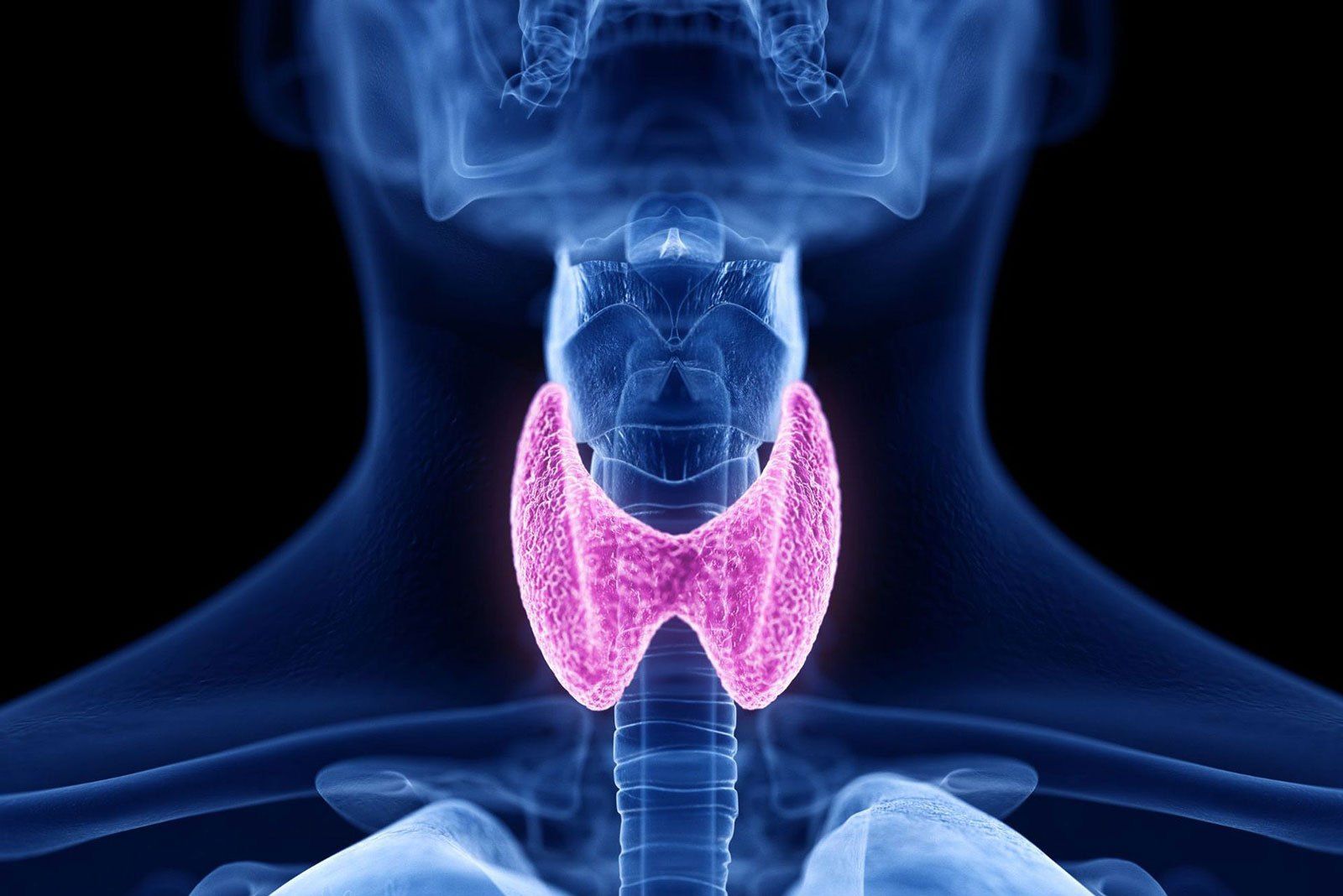 Hashimoto Thyreoiditis